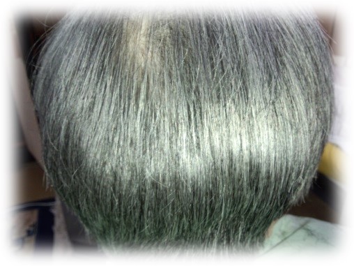 ブラッシング前